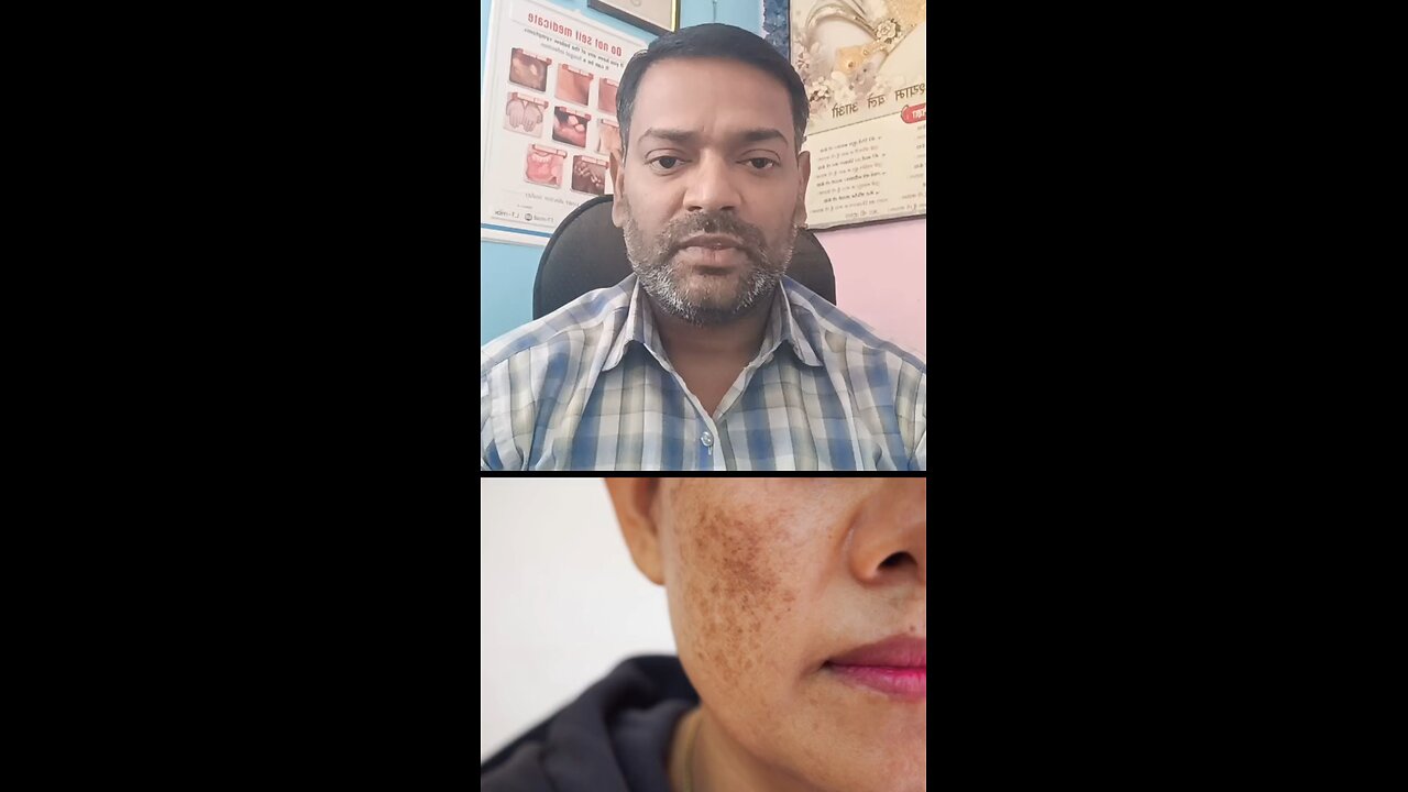 चेहरे की समस्या का इलाज ।