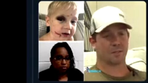 BLACK DAYCARE WORKER ABUSES WHITE ONE YR OLD TODDLER; MEDIA IGNORES? 🔥