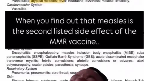 MMR Vaccine Side Effect … MEASLES 😂