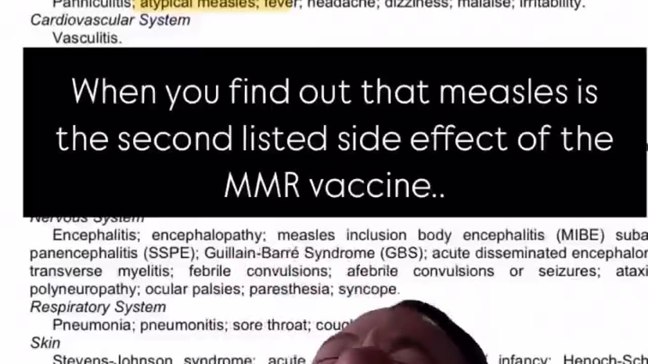 MMR Vaccine Side Effect … MEASLES 😂