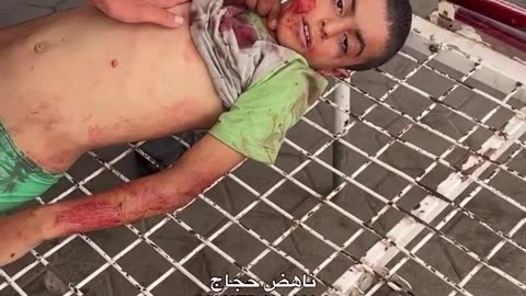 A child is breathing his last breaths