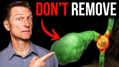 Dr. Eric Berg - Never Get Your Gallbladder Removed