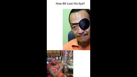 How BK Lost His Eye?