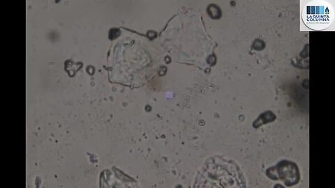 "Flu Vaccine News: Graphene Presence Detected in 'Vaxigrip Tetra'"