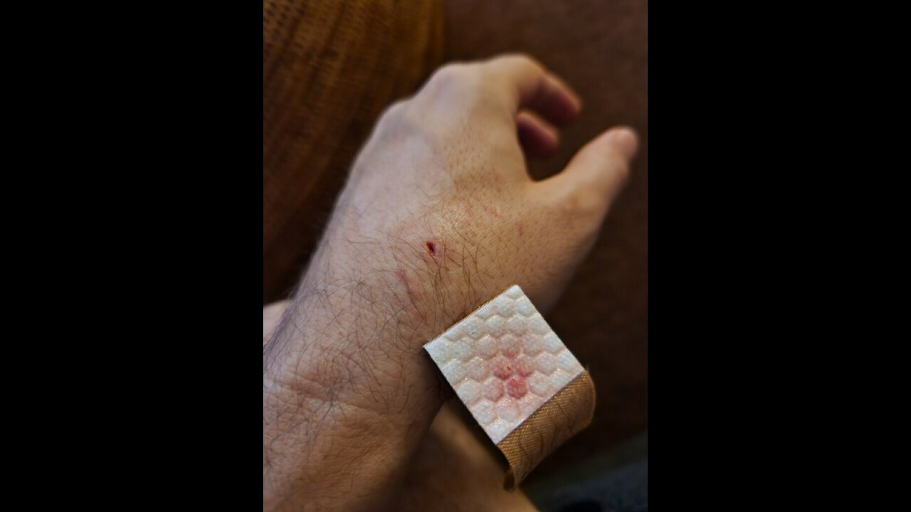 Update on My Son’s dog & Bite