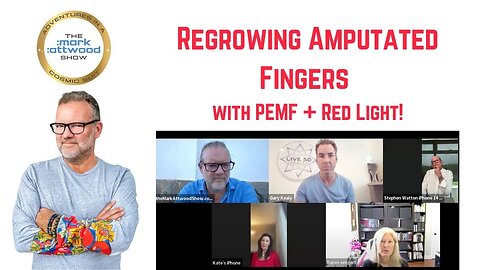 Regrowing Amputated Fingers with PEMF + Red Light! - 5th June 2025