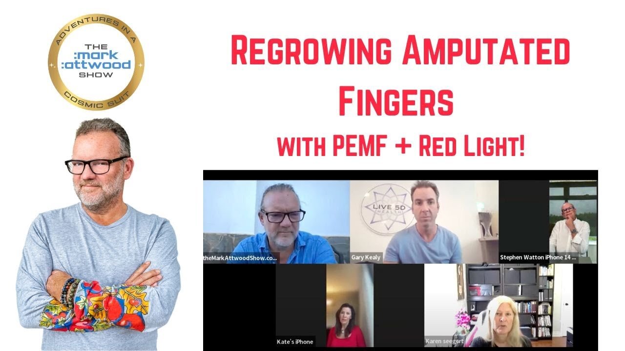 Regrowing Amputated Fingers with PEMF + Red Light! - 5th June 2025