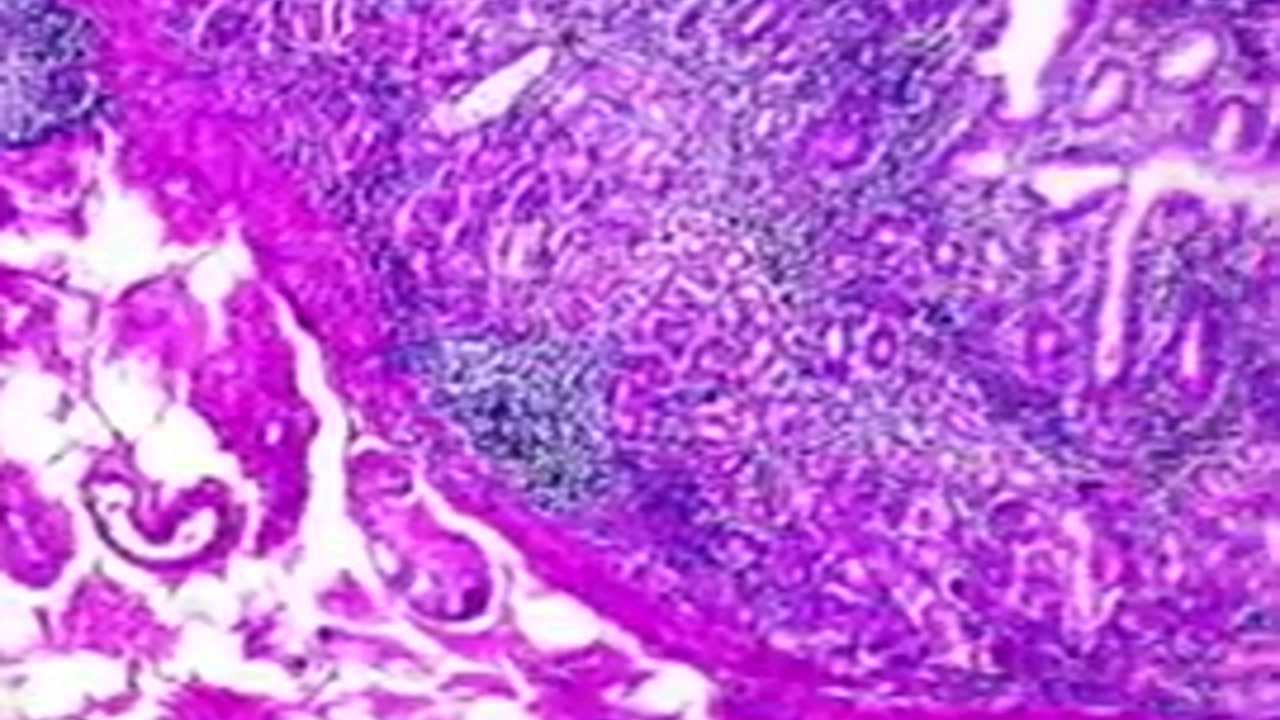 About Electron Microscopes - Dr. Andrew Kaufman