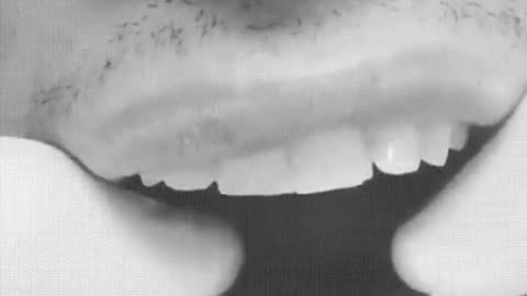 Shocking Broken Jaw Moves in Two Directions