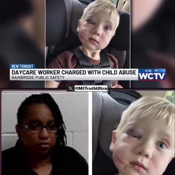 Georgia Daycare Worker Charged with Aggravated Battery and First-Degree Child Abuse