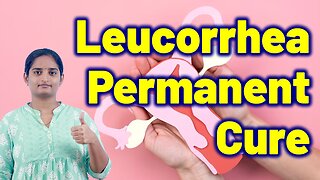 Best Treatment for Leucorrhea in Women | Vaginal discharge Dr. Bharadwaz | Homeopathy, Medicine