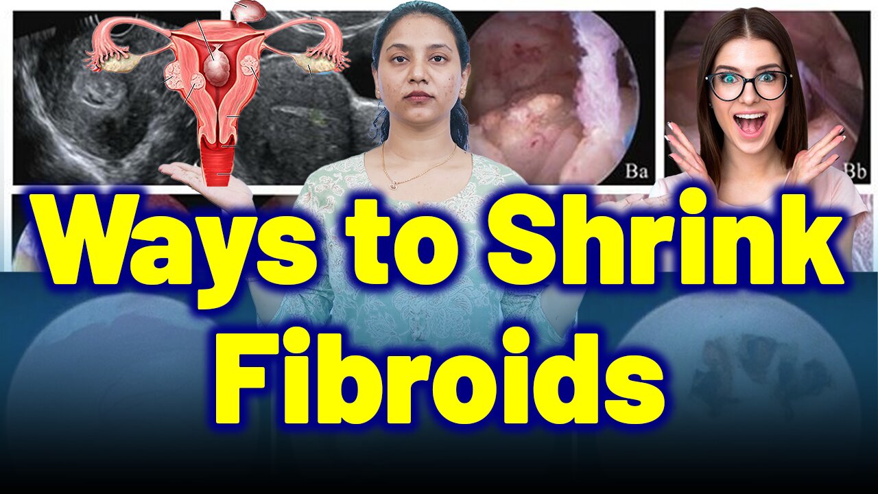 "Best Fibroid Shrinkage Techniques: Myolysis, Laparoscopic & Ultrasound Explained |Treatment Cure |