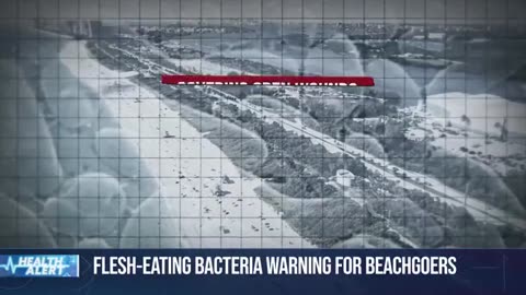 Four people dead from flesh-eating bacteria in Florida