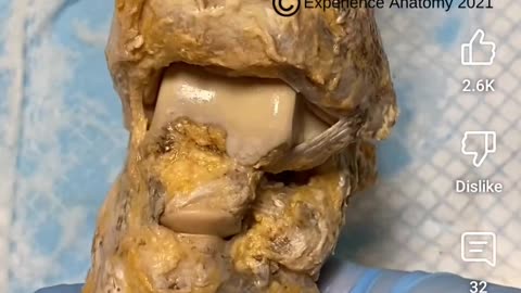 Real Bone and joints