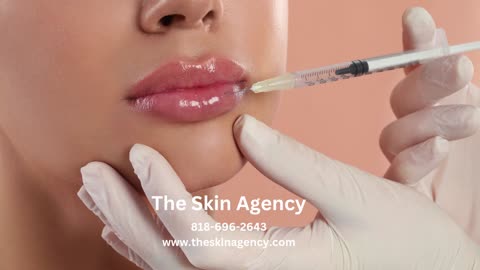 Lip Fillers Glendale