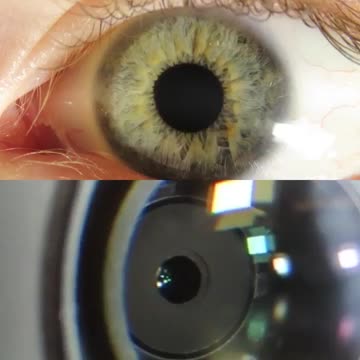The reaction time of a camera vs. the human eye when suddenly hit with 12,000 lumens of light