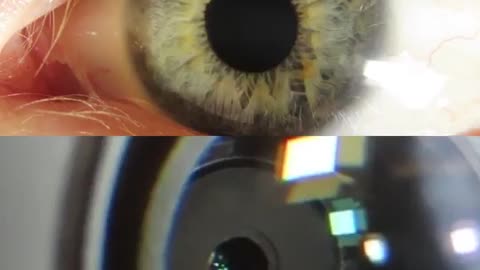 The reaction time of a camera vs. the human eye when suddenly hit with 12,000 lumens of light 