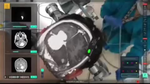 Ai things