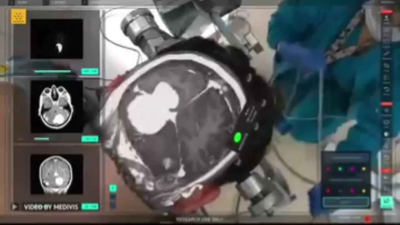 Ai things