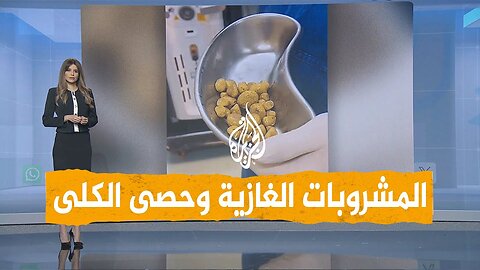 شبكات _ استخراج 30 حصوة من كلية مريض بسبب المشروبات الغازية