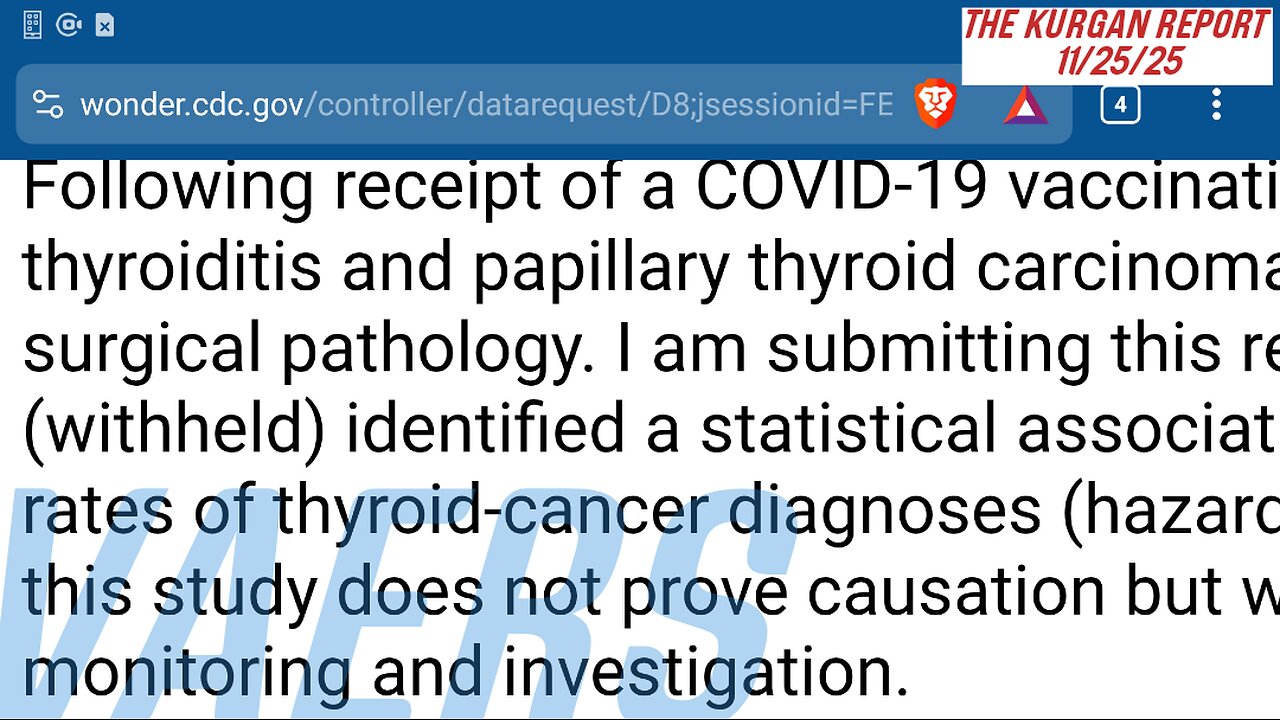 VAERS: ANOTHER 25 YR OLD BECOMES CONSPIRACY ANALYST, THE HARD WAY!