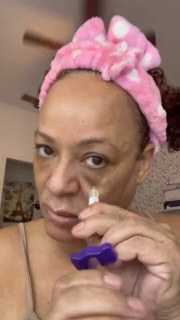 DIY meso volasome on orbital bone!