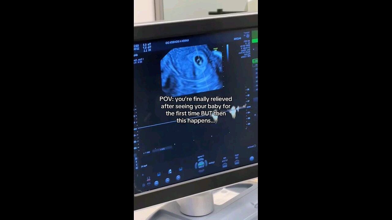 Best gift for pregnant mommy🤰