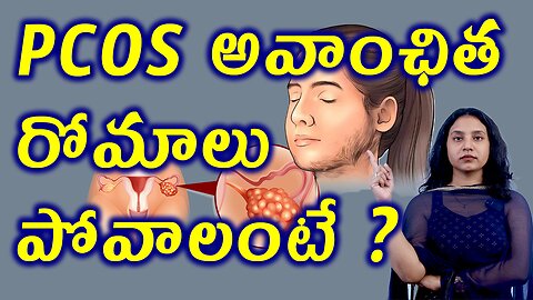 PCOS అవాంఛిత రోమాలు పోవాలంటే? PCOS Effect Hirsutism Female Unwanted Hair Causes Signs Cure Treatment