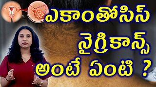 ఎకాంతోసిస్ నైగ్రికాన్స్ అంటే ఏంటి? What is Acanthosis Nigricans ? Skin Darkening in PCOS Treatment