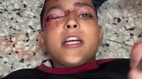 A child survivor of the Al-Nasr ma-ssac-re recounts the horror
