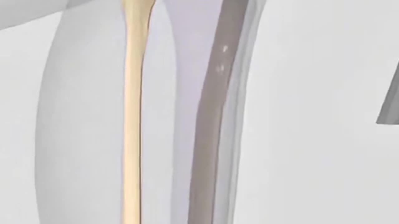 Tibia Interlocking Nail Surgery 🔩 Fixing Broken Leg Bone Step-by-Step