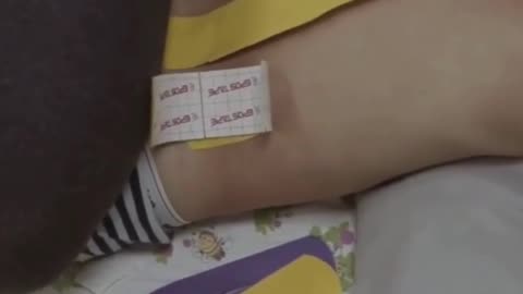 Watch How Taping Therapy Works at Sri Sai Physio