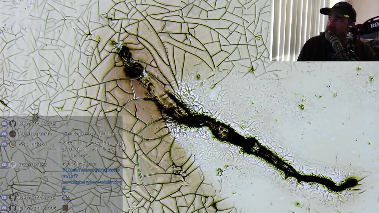 Prion Background & Pathology (clip)