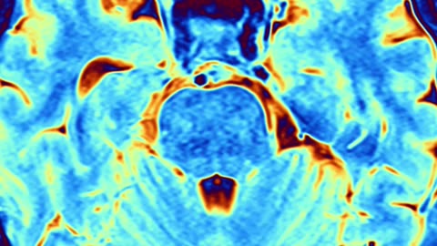How MeditationReading Rewires Your Brain #mentalhealth #shorts