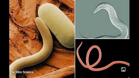 017 Pasożyty, tłuszczaki jak powstaje fermentacja komórkowa.