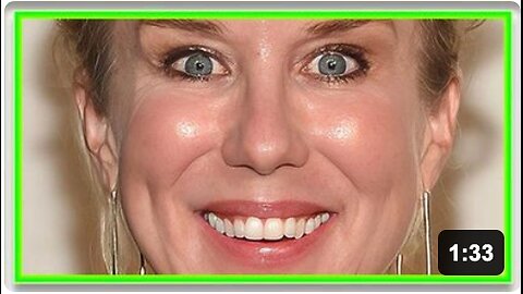 Comedian suffers VAXX induced BELL'S PALSY