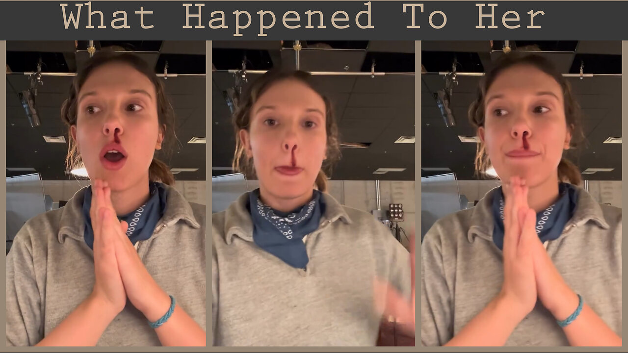 What Happened to Millie Bobby Brown’s Face? Coffee Break Fail? BTS