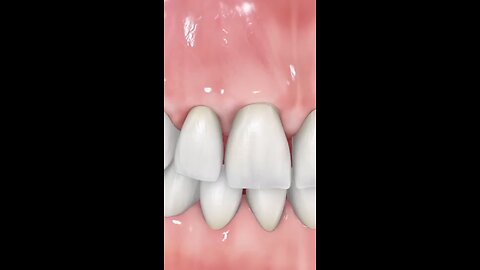 The Celebrity Secret To Perfect Teeth😬✨