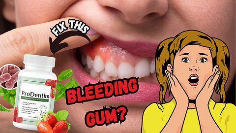 PRODENTIM REVIEW _⛔CAUTION⛔_ Prodentim Candy -prodentim supplement - Gum Teeth -Prodentim BBB Review