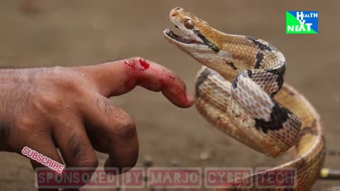 First Aid for a snake bite