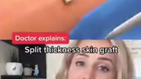 Viral: #Doctor reacts: Foot transplant surgery