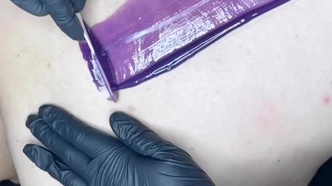 💜 Back Waxing with Sexy Smooth Purple Seduction Hard Wax | Satisfying Results by @moodyxskincare