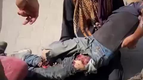 My God...A Palestinian mother carries the lifeless body of her son