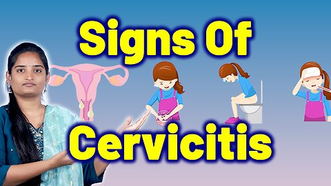 Signs & Symptoms Of Cervicitis, Chronic Cervicitis, Infective Cervicitis. Homeopathy Medicine & Cure