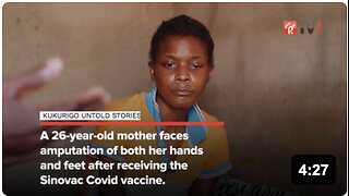HORRIFIC: Sinovac Covid Vaccine Victim Cleopatra Ncube - Needs Both Hands and Feet Amputated 💉