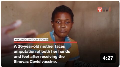 HORRIFIC: Sinovac Covid Vaccine Victim Cleopatra Ncube - Needs Both Hands and Feet Amputated 💉