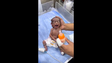 preterm baby feeding