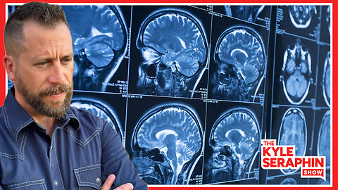 COVID Shrunk your BRAIN! But that isn't a good excuse... | Ep 616