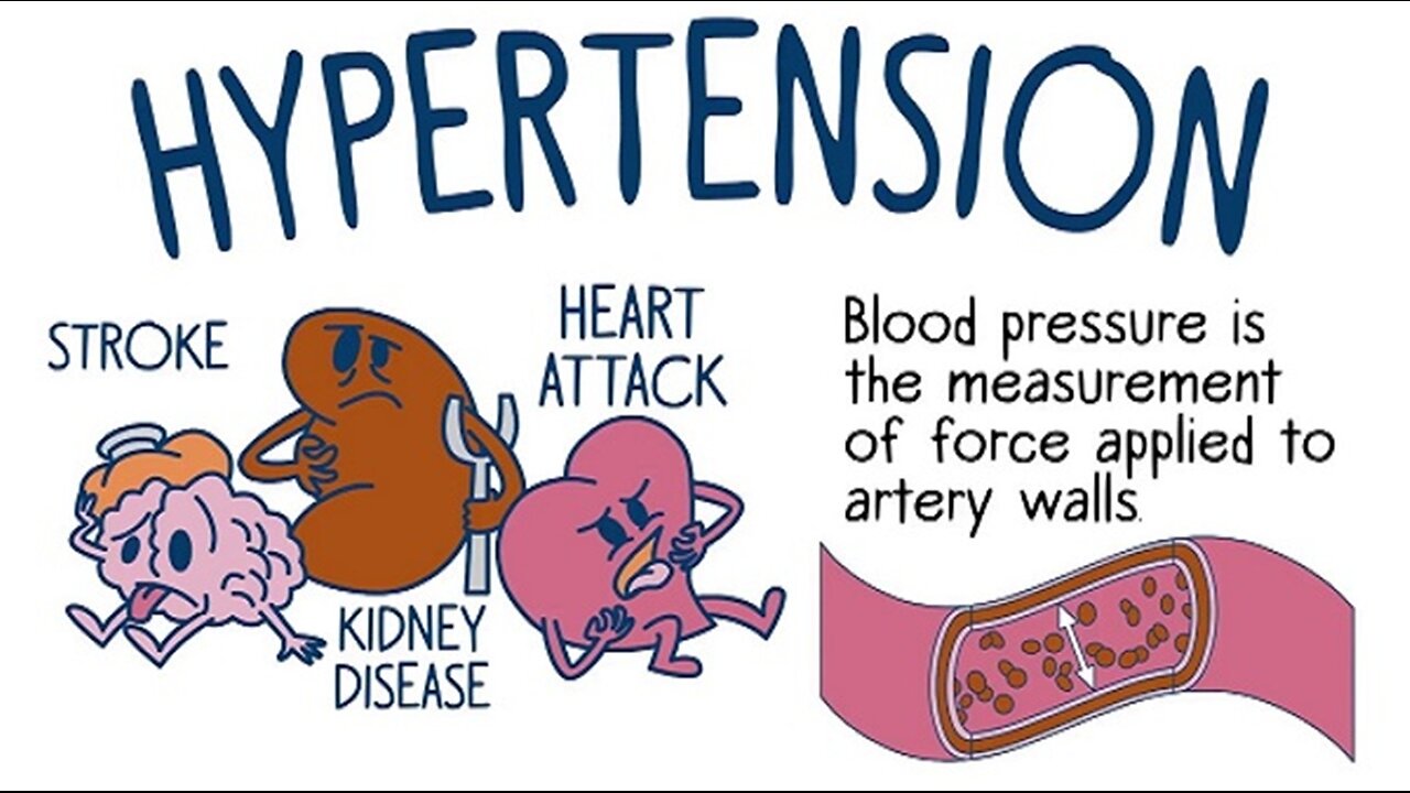 High Blood Pressure - The Silent Killer