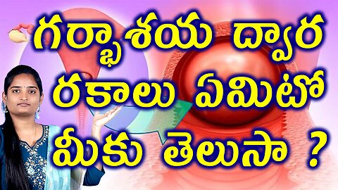 గర్భాశయ ద్వార రకాలు తెలుసా ? Types of Infected Cervix Explained Clearly | Cervicitis Homeopathy Cure